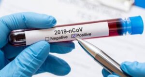 Jammu: 72 prisoners test +ve in jail